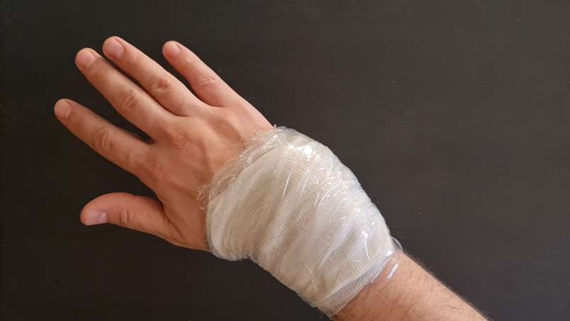 Vaistas su lojais ir kopūstų lapais, nuotrauka 7