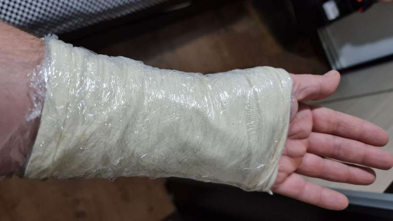 Vaistas su lojais ir kopūstų lapais, nuotrauka 8